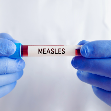 Measles case confirmed in Middle Tennessee school system
